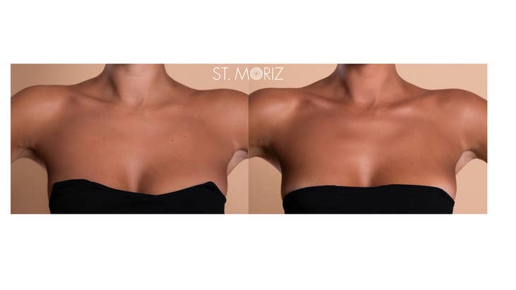 St. Moriz Professional Self-Tanning Mousse Dark